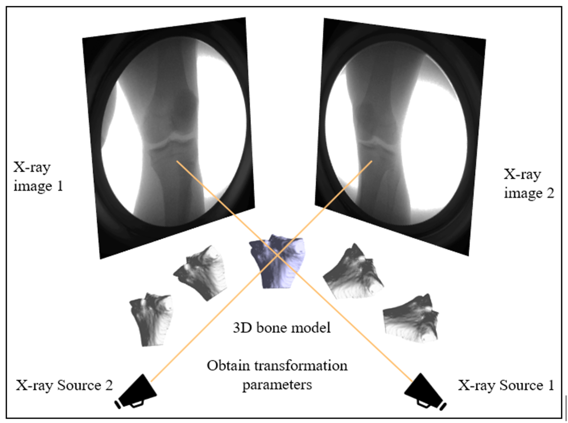 Figure 1. Illustration of the 2D-3D registration.