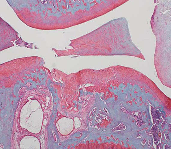 Model knee joint showing diet-induced metabolic osteoarthritis