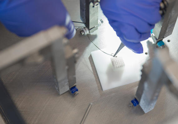 Health IT Imaging Software to Assess Aneurysm Wall Strength