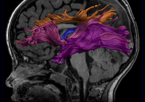 New Methods for Youth Concussion Diagnosis and Assessment